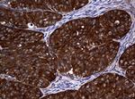 NME1 Antibody in Immunohistochemistry (Paraffin) (IHC (P))