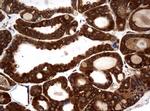 NME1 Antibody in Immunohistochemistry (Paraffin) (IHC (P))