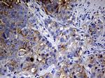 NME1 Antibody in Immunohistochemistry (Paraffin) (IHC (P))