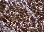 NME1 Antibody in Immunohistochemistry (Paraffin) (IHC (P))