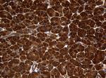 NME1 Antibody in Immunohistochemistry (Paraffin) (IHC (P))