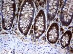 NME1 Antibody in Immunohistochemistry (Paraffin) (IHC (P))