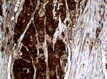 NME1 Antibody in Immunohistochemistry (Paraffin) (IHC (P))