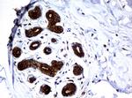 NME1 Antibody in Immunohistochemistry (Paraffin) (IHC (P))