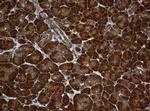 NME1 Antibody in Immunohistochemistry (Paraffin) (IHC (P))