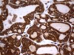 NME1 Antibody in Immunohistochemistry (Paraffin) (IHC (P))