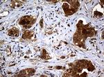 NME1 Antibody in Immunohistochemistry (Paraffin) (IHC (P))