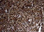 NME1 Antibody in Immunohistochemistry (Paraffin) (IHC (P))