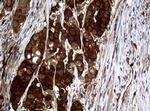 NME1 Antibody in Immunohistochemistry (Paraffin) (IHC (P))