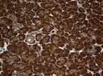 NME1 Antibody in Immunohistochemistry (Paraffin) (IHC (P))