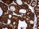 NME1 Antibody in Immunohistochemistry (Paraffin) (IHC (P))