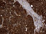 NME1 Antibody in Immunohistochemistry (Paraffin) (IHC (P))