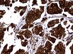 NME1 Antibody in Immunohistochemistry (Paraffin) (IHC (P))