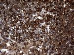 NME1 Antibody in Immunohistochemistry (Paraffin) (IHC (P))