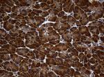 NME1 Antibody in Immunohistochemistry (Paraffin) (IHC (P))