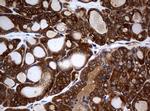 NME1 Antibody in Immunohistochemistry (Paraffin) (IHC (P))