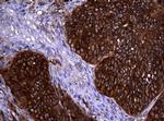 NME1 Antibody in Immunohistochemistry (Paraffin) (IHC (P))