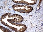 NME1 Antibody in Immunohistochemistry (Paraffin) (IHC (P))