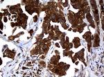 NME1 Antibody in Immunohistochemistry (Paraffin) (IHC (P))