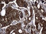 NME1 Antibody in Immunohistochemistry (Paraffin) (IHC (P))