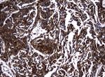 NME1 Antibody in Immunohistochemistry (Paraffin) (IHC (P))