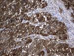 NME1 Antibody in Immunohistochemistry (Paraffin) (IHC (P))