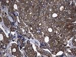 NME1 Antibody in Immunohistochemistry (Paraffin) (IHC (P))