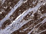 NME1 Antibody in Immunohistochemistry (Paraffin) (IHC (P))