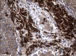 NME1 Antibody in Immunohistochemistry (Paraffin) (IHC (P))