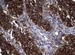 NME1 Antibody in Immunohistochemistry (Paraffin) (IHC (P))