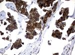 NME1 Antibody in Immunohistochemistry (Paraffin) (IHC (P))