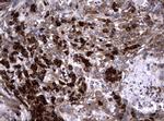 NME1 Antibody in Immunohistochemistry (Paraffin) (IHC (P))