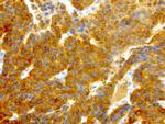 NME1 Antibody in Immunohistochemistry (Paraffin) (IHC (P))
