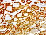 NME1 Antibody in Immunohistochemistry (Paraffin) (IHC (P))