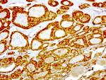 NME1 Antibody in Immunohistochemistry (Paraffin) (IHC (P))