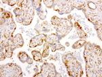 NME1 Antibody in Immunohistochemistry (Paraffin) (IHC (P))