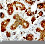 NME1 Antibody in Immunohistochemistry (Paraffin) (IHC (P))