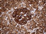 NME1 Antibody in Immunohistochemistry (Paraffin) (IHC (P))