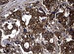 NME1 Antibody in Immunohistochemistry (Paraffin) (IHC (P))