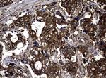 NME1 Antibody in Immunohistochemistry (Paraffin) (IHC (P))