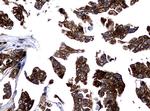 NME1 Antibody in Immunohistochemistry (Paraffin) (IHC (P))