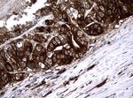 NME1 Antibody in Immunohistochemistry (Paraffin) (IHC (P))