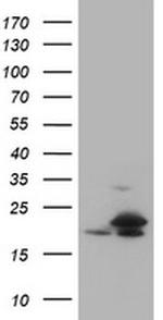 NME1 Antibody in Western Blot (WB)