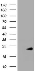 NME1 Antibody in Western Blot (WB)