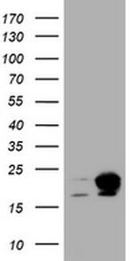 NME1 Antibody in Western Blot (WB)