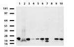 NME1 Antibody in Western Blot (WB)