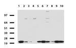 NME1 Antibody in Western Blot (WB)