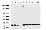 NME1 Antibody in Western Blot (WB)