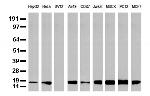 NME1 Antibody in Western Blot (WB)