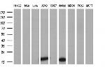 NME4 Antibody in Western Blot (WB)